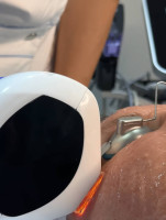 Lumecca® - Lumecca-step-2